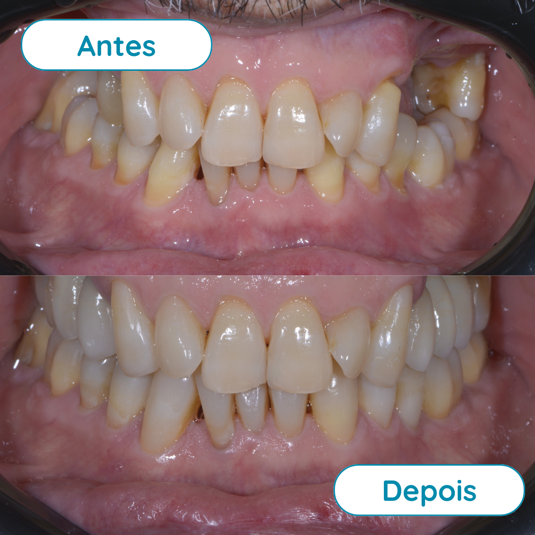 Reabilitação Oral