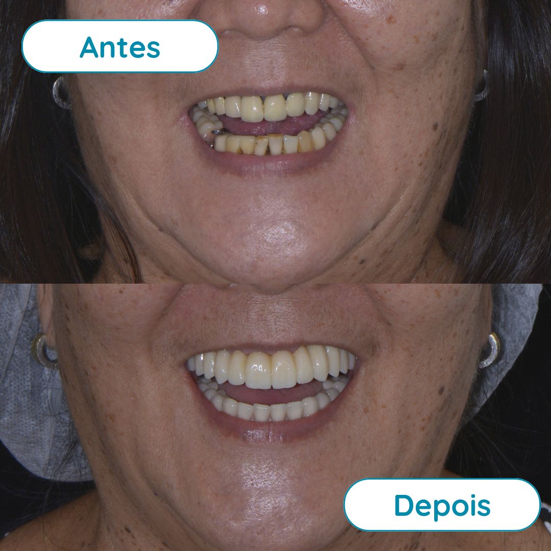 Protocolo Dentário